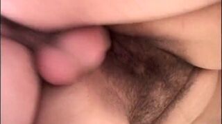 This hairy cunt excites me! - 13 image