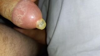 Desi deck massage in condom - 3 image
